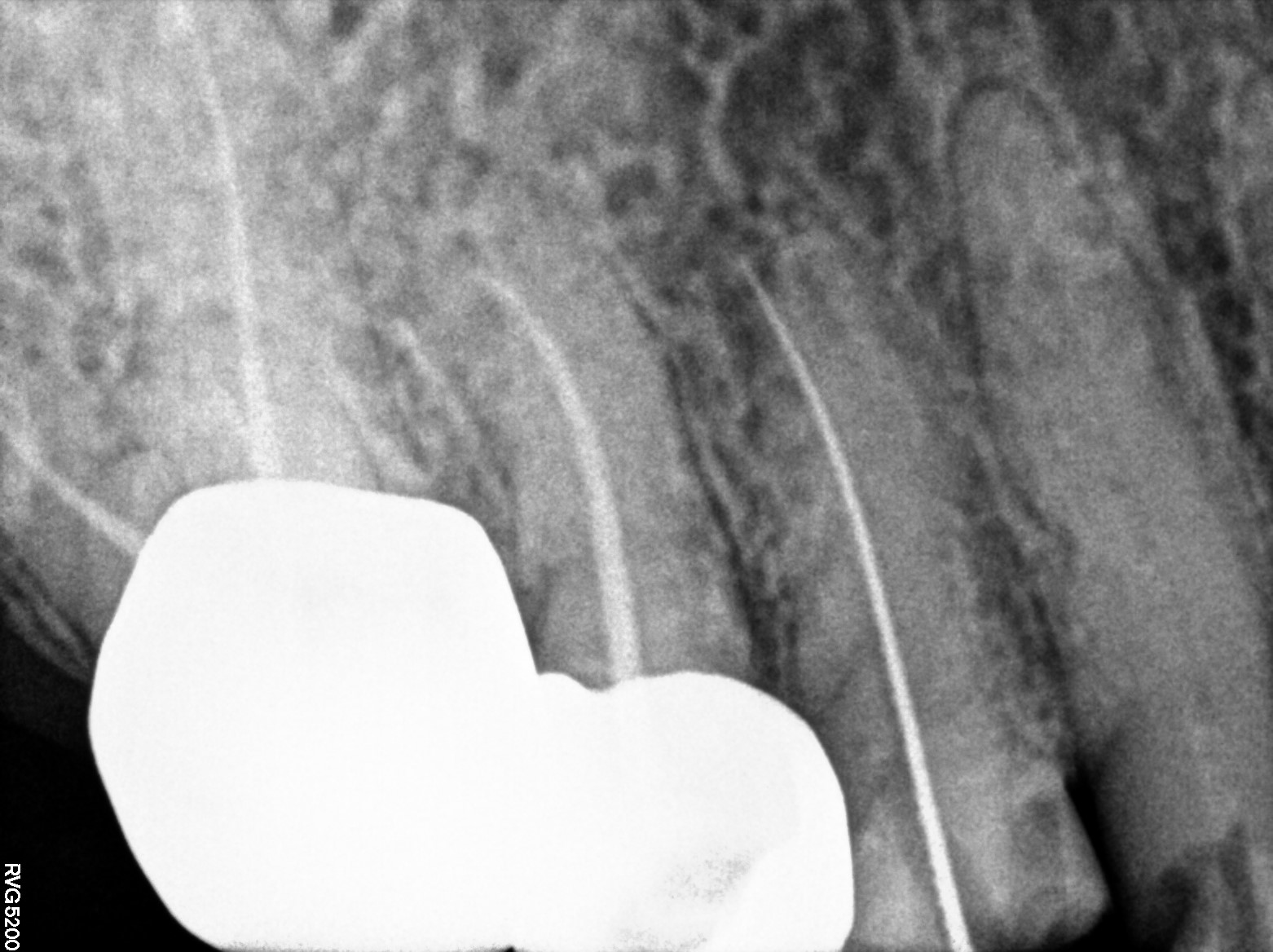 Dental X-ray